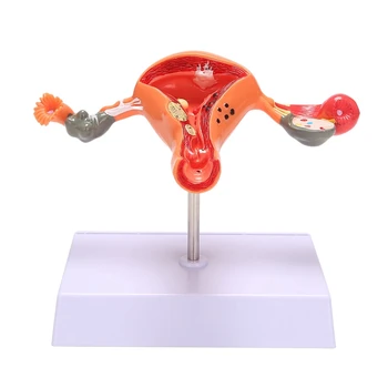 Модел на матката Модел на Яйчниците Анатомията на Женския Репродуктивен Орган Модел Показва Матката Яйчник Влагалището Обучение на Матката